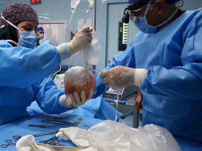 انجام رایگان پیشرفته‌ترین اعمال جراحی قلب در بیمارستان شهید لواسانی
