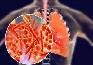 بیماری انسدادی مزمن ریه چهارمین علت مرگومیر جهان است