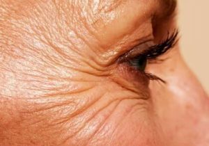 چگونه با افزایش سن از &laquo;پروتئین نگهدارنده بدن&raquo; مراقبت کنیم؟